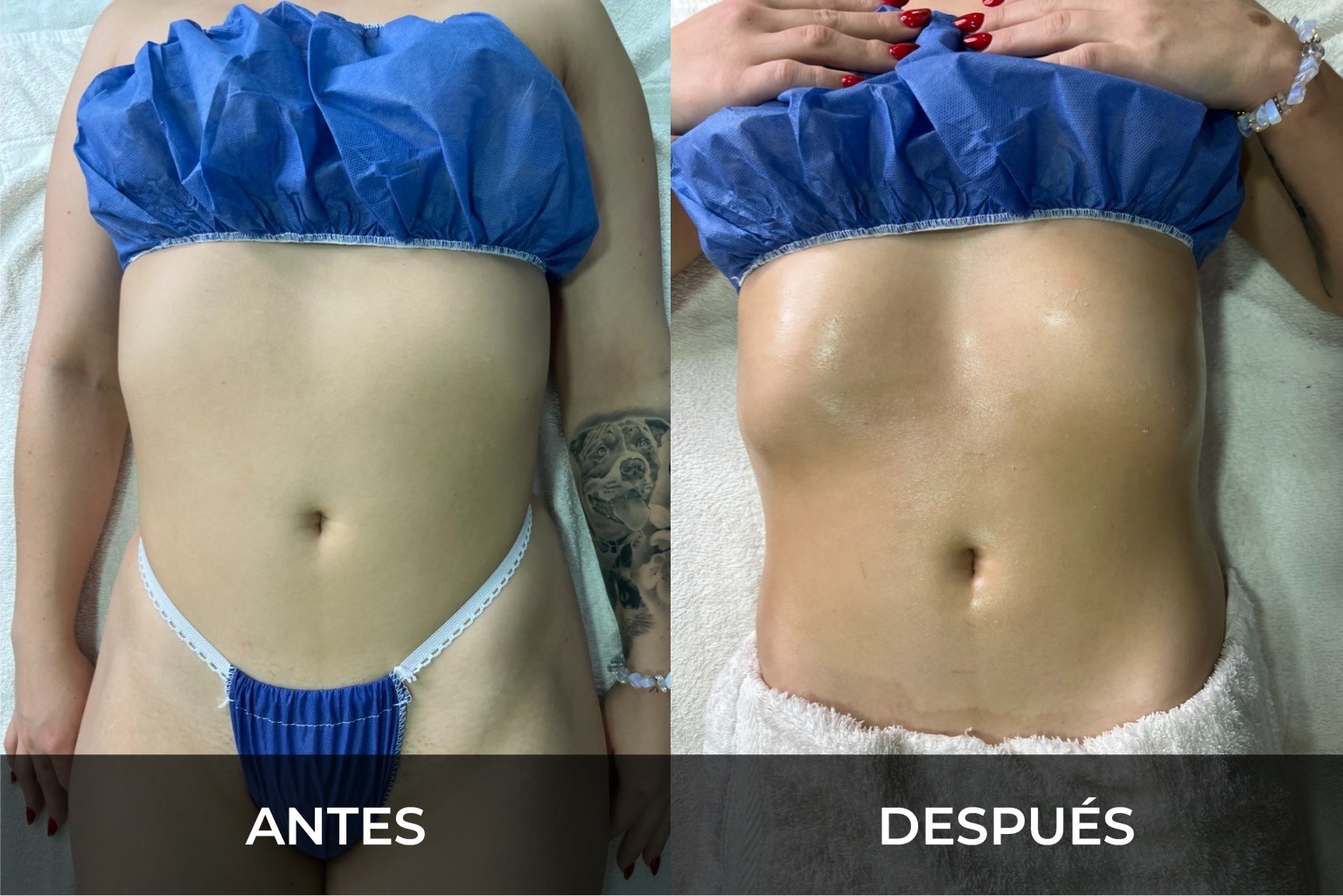 Evidencia fotográfica antes y después 3