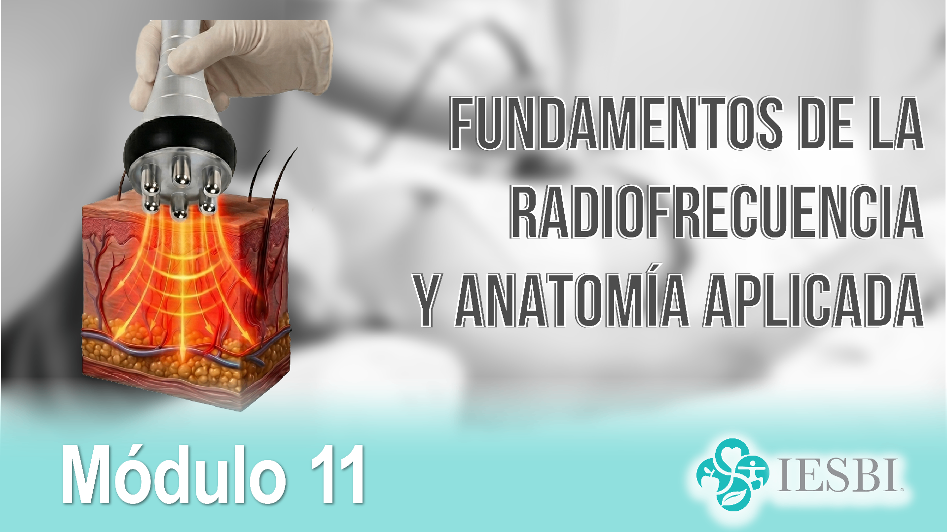 Fundamentos de la Radiofrecuencia y Anatomía Aplicada