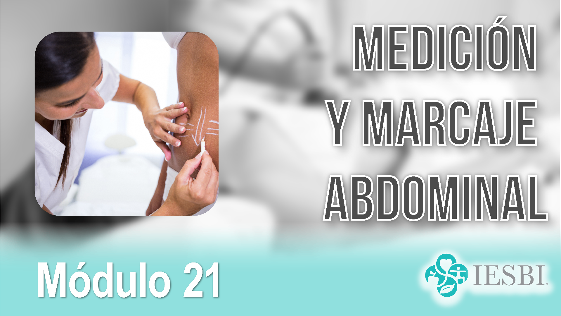 Medición y Marcaje Abdominal