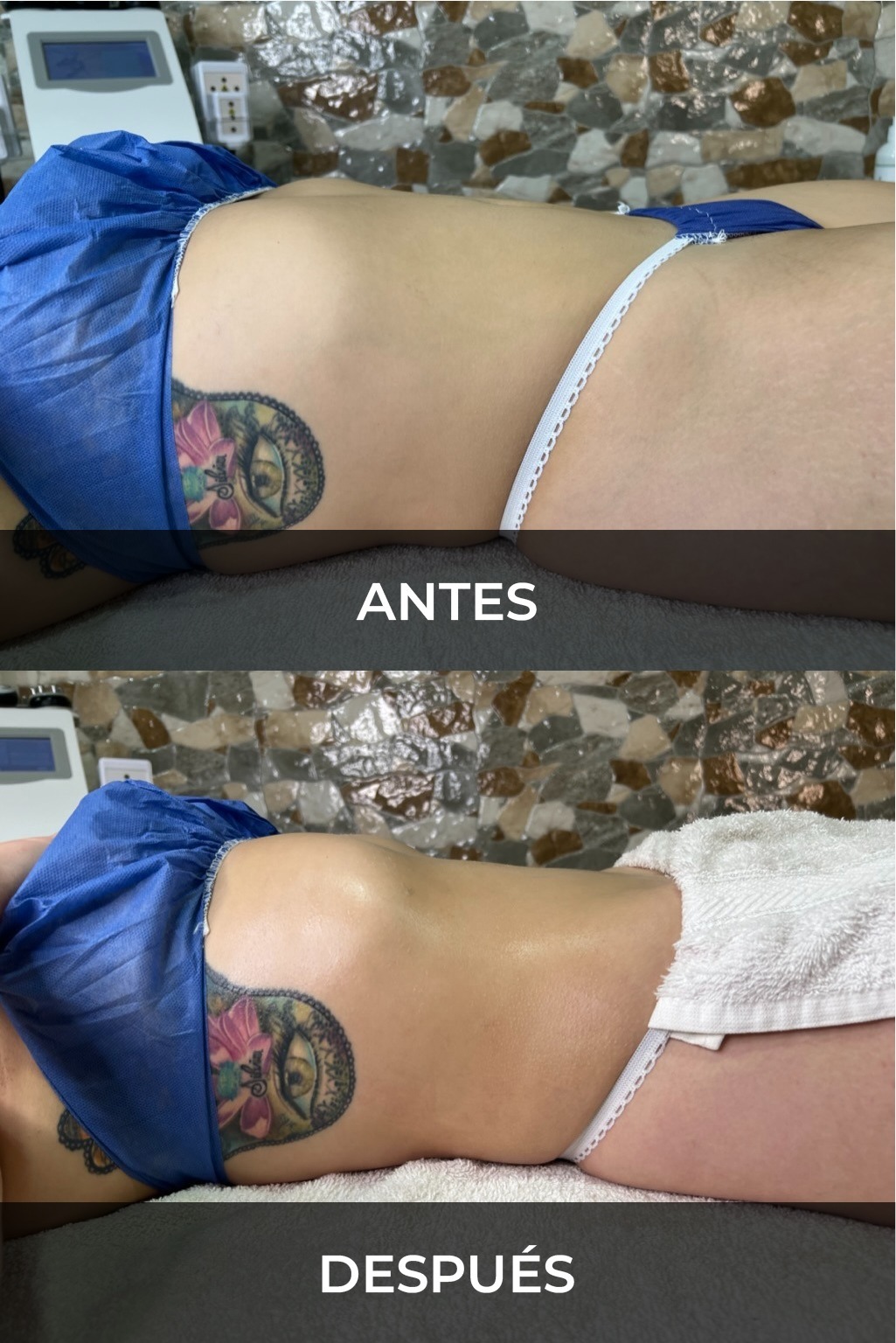 Evidencia fotográfica antes y después 1