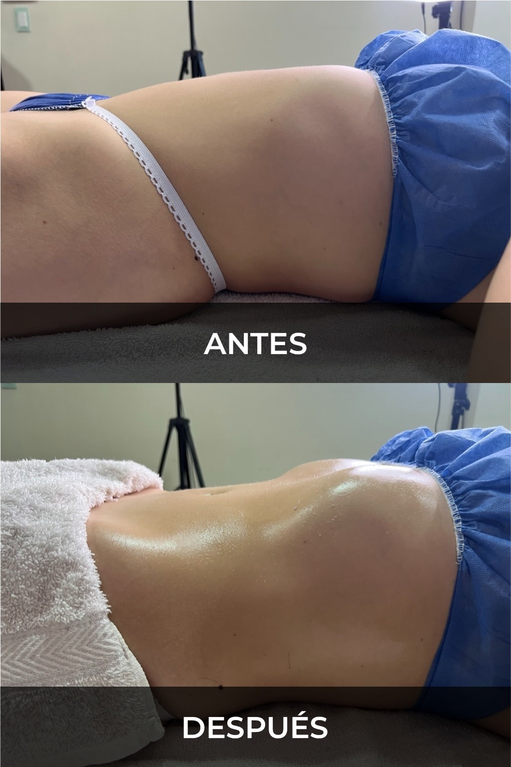 Evidencia fotográfica antes y después 2