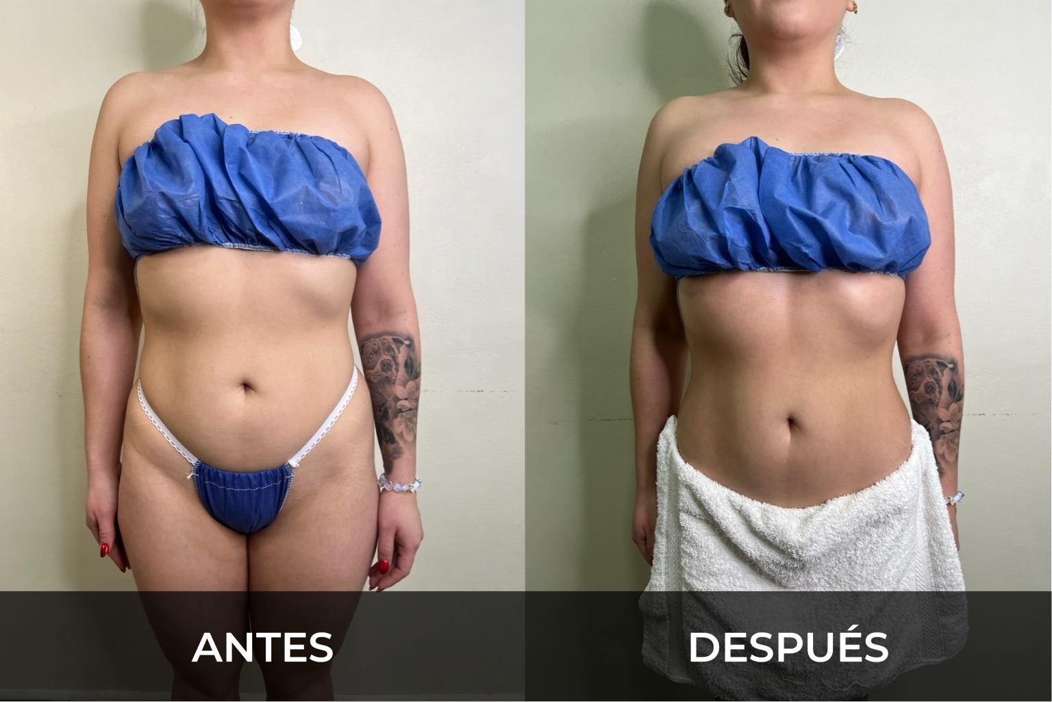 Evidencia fotográfica antes y después 4