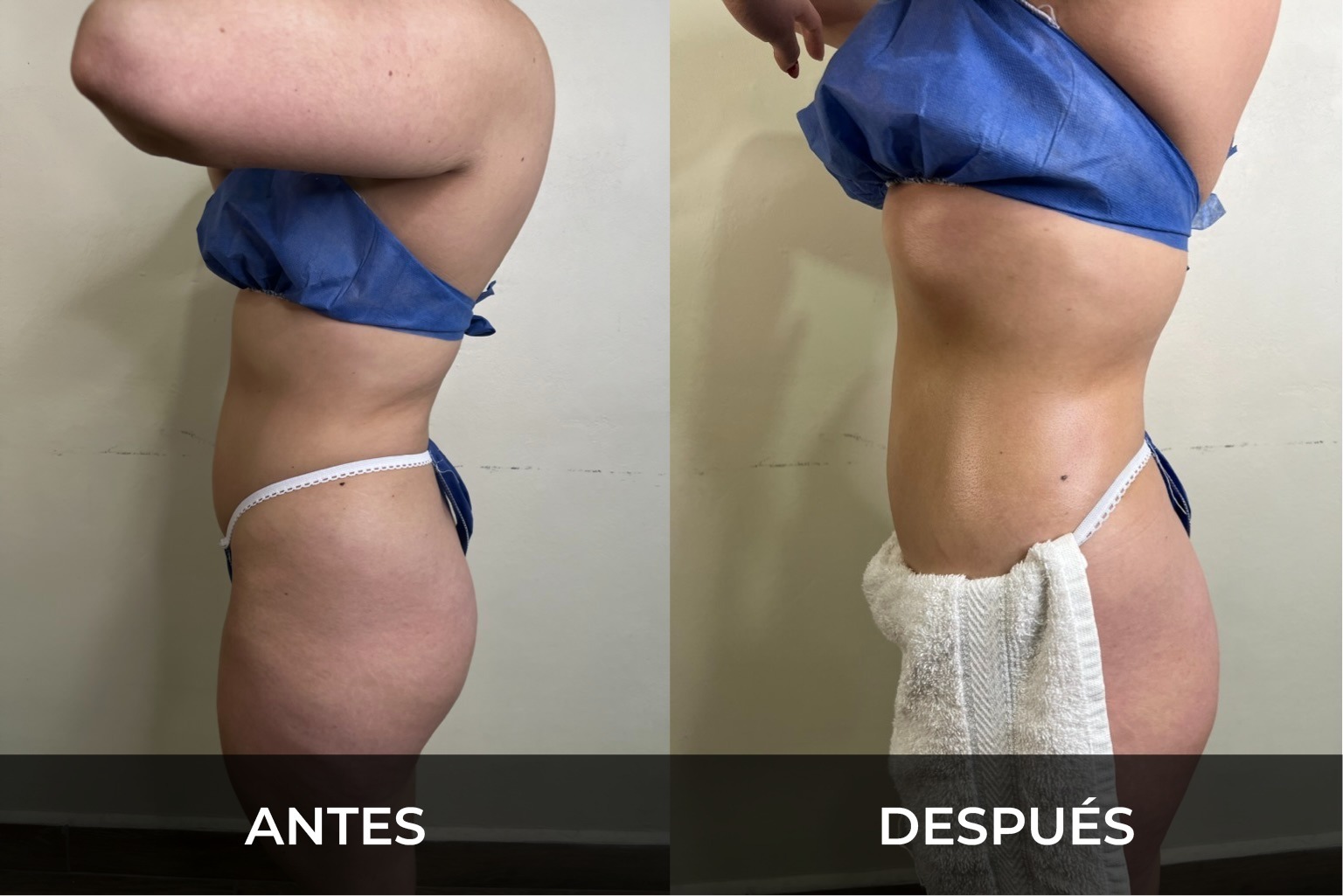 Evidencia fotográfica antes y después 5