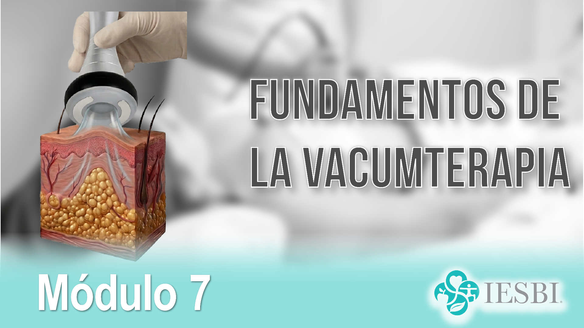 Fundamentos de la Vacumterapia